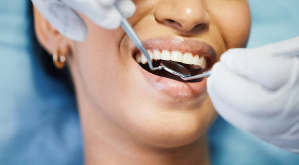 Best Emergency Tooth Extraction in Logan, WV